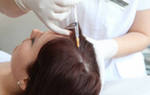 Мезотерапия как способ восстановления волос